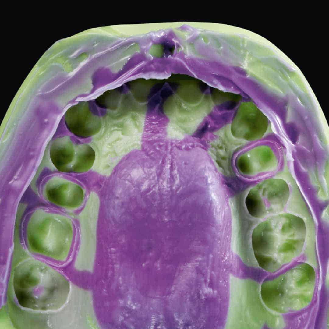 Panasil® initial contact x-light afdruk